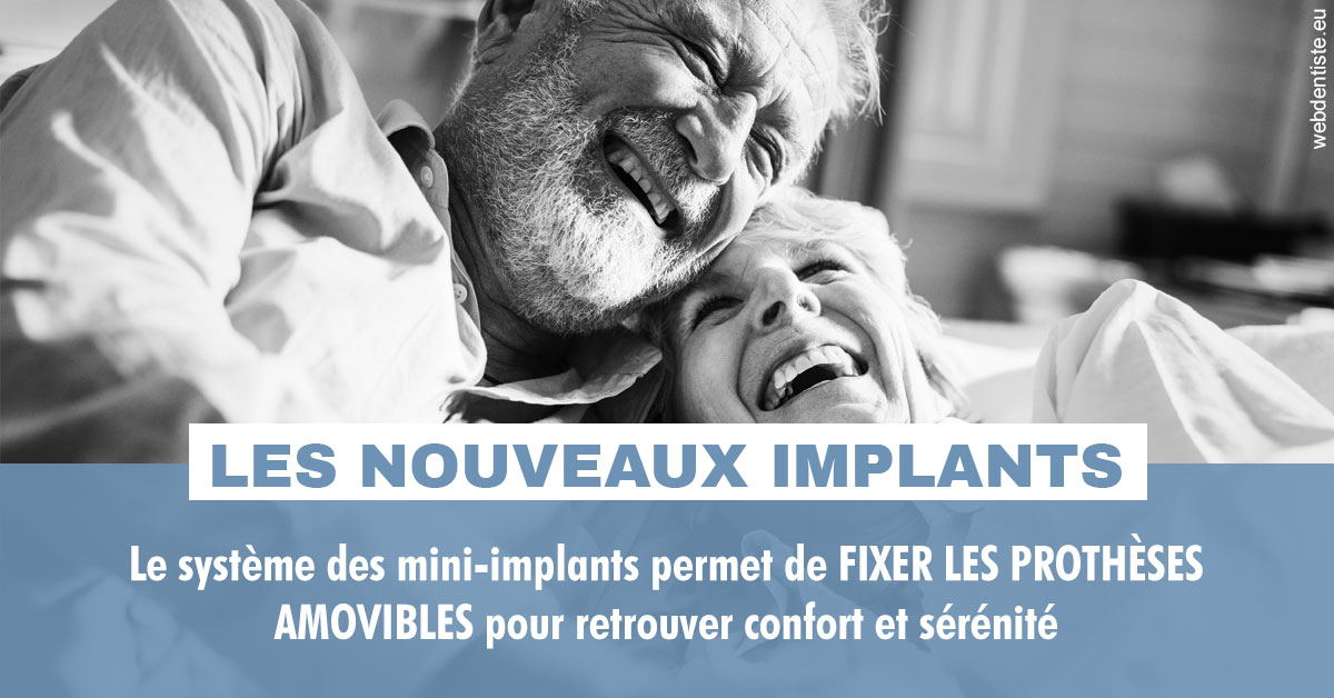 https://dr-kebir-quelin-myriam.chirurgiens-dentistes.fr/Les nouveaux implants 2