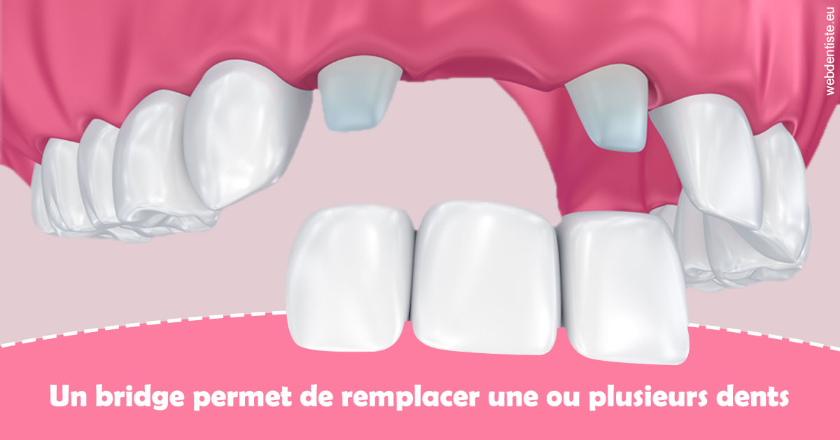 https://dr-kebir-quelin-myriam.chirurgiens-dentistes.fr/Bridge remplacer dents 2