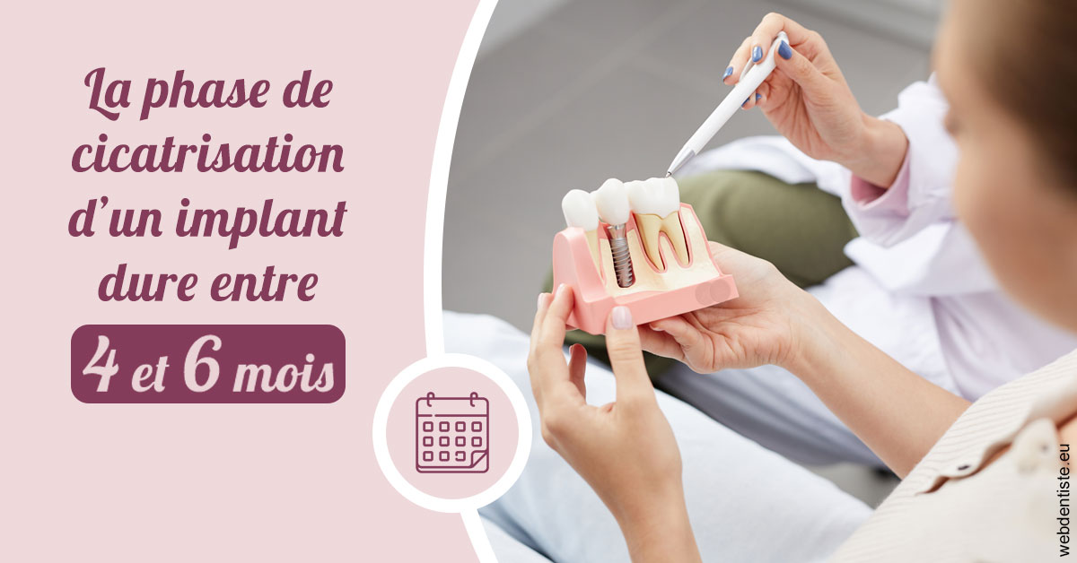 https://dr-kebir-quelin-myriam.chirurgiens-dentistes.fr/Cicatrisation implant 2