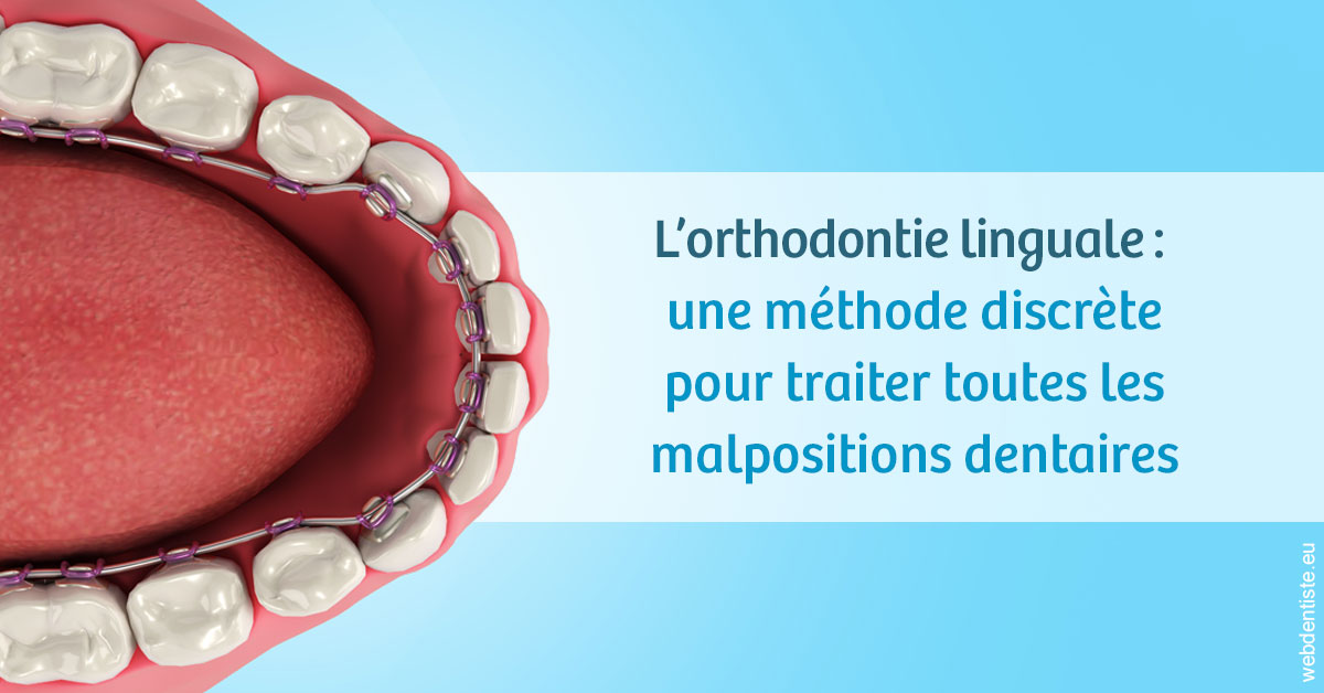 https://dr-kebir-quelin-myriam.chirurgiens-dentistes.fr/L'orthodontie linguale 1