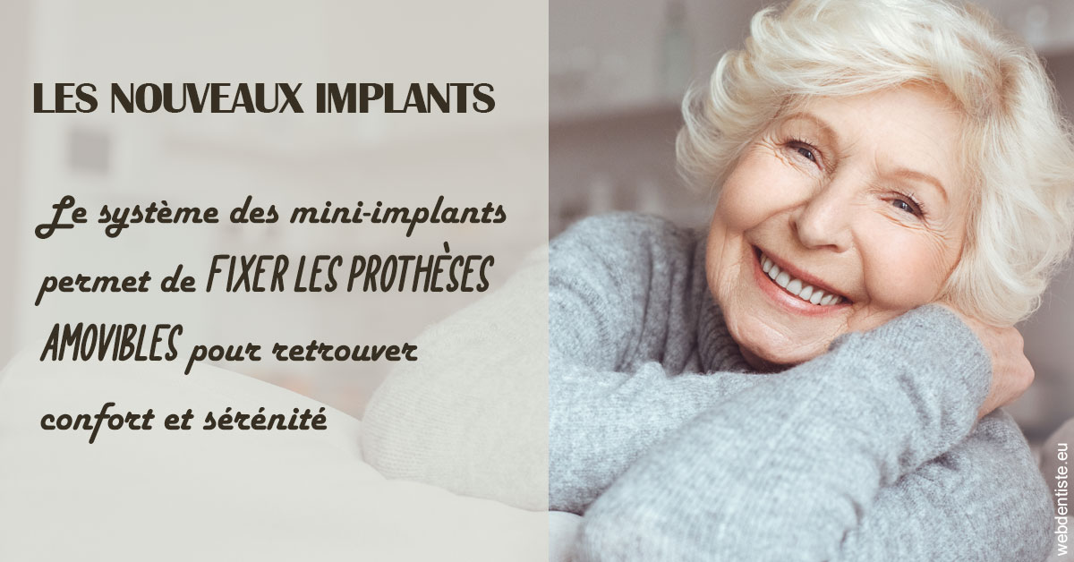 https://dr-kebir-quelin-myriam.chirurgiens-dentistes.fr/Les nouveaux implants 1
