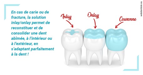 https://dr-kebir-quelin-myriam.chirurgiens-dentistes.fr/L'INLAY ou l'ONLAY
