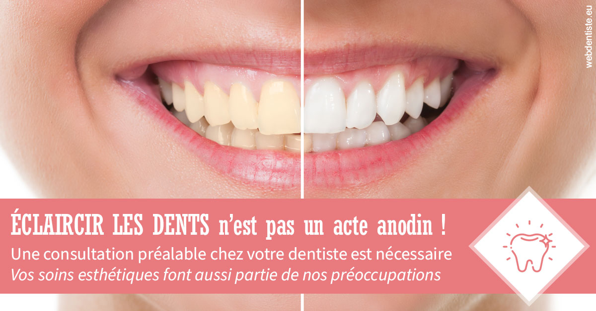 https://dr-kebir-quelin-myriam.chirurgiens-dentistes.fr/Eclaircir les dents 1