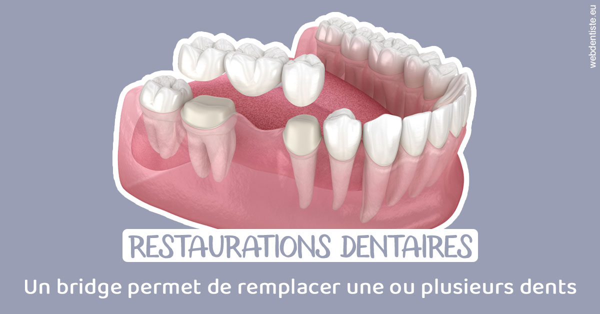 https://dr-kebir-quelin-myriam.chirurgiens-dentistes.fr/Bridge remplacer dents 1