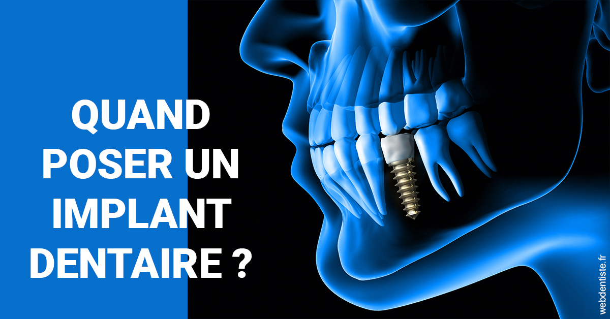 https://dr-kebir-quelin-myriam.chirurgiens-dentistes.fr/Les implants 1