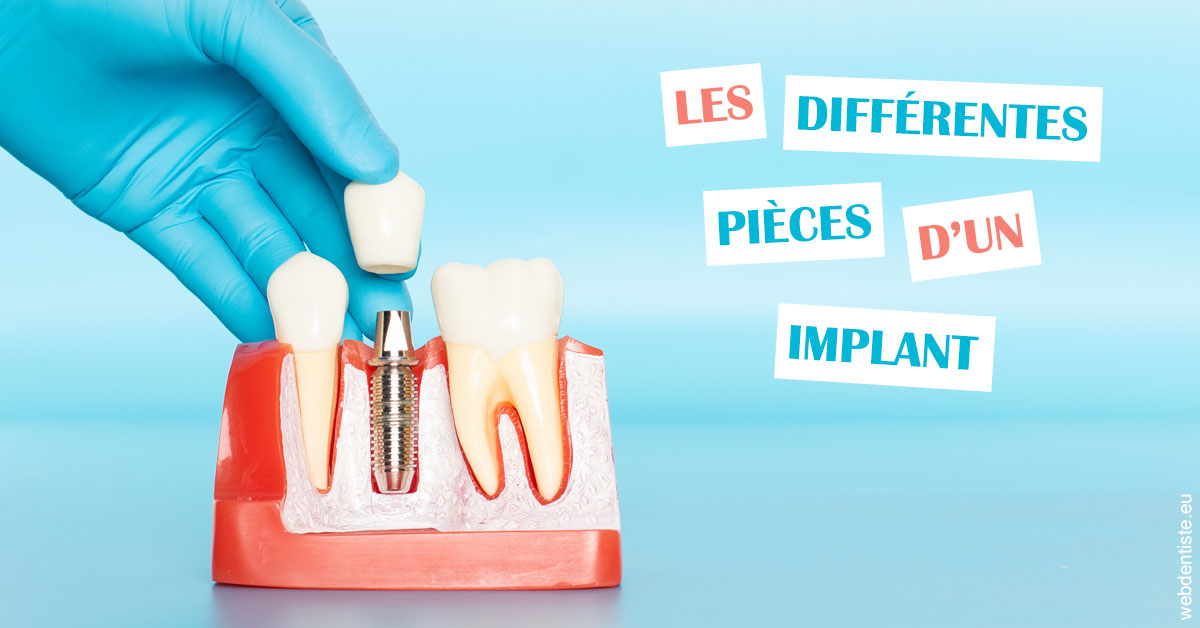 https://dr-kebir-quelin-myriam.chirurgiens-dentistes.fr/Les différentes pièces d’un implant 2