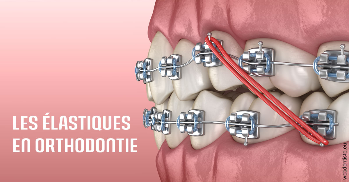 https://dr-kebir-quelin-myriam.chirurgiens-dentistes.fr/Elastiques orthodontie 2