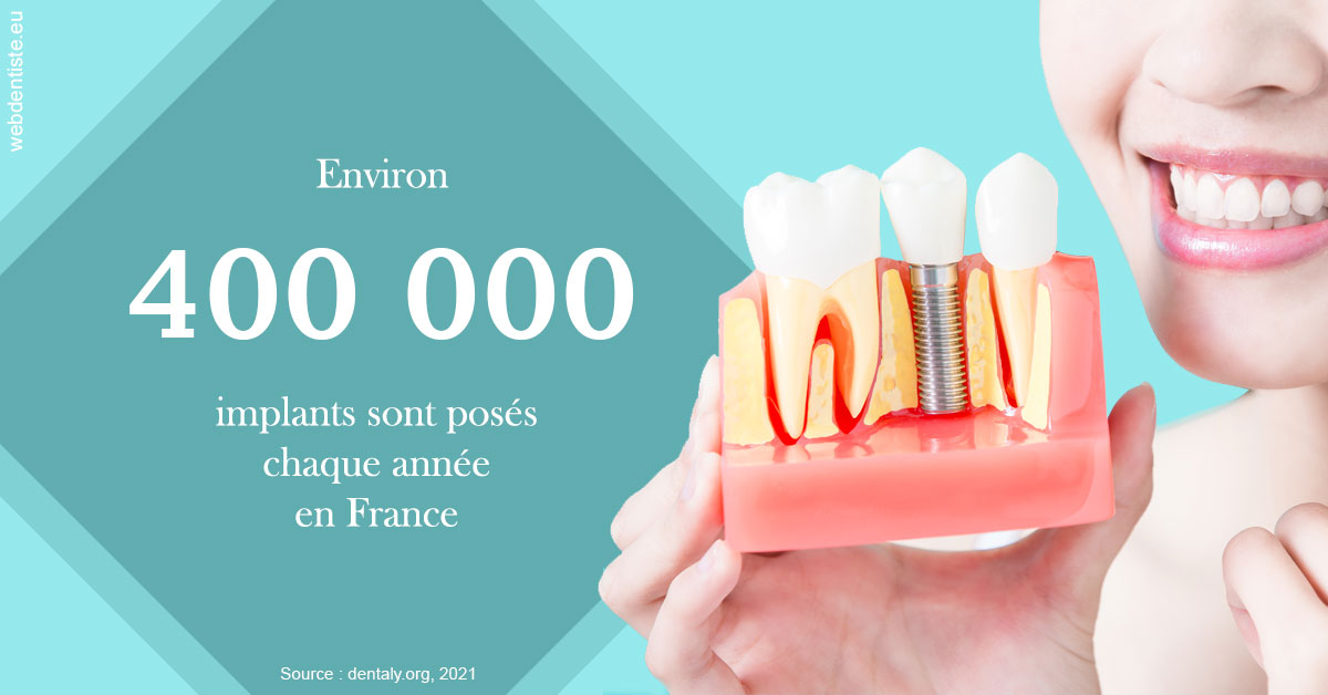 https://dr-kebir-quelin-myriam.chirurgiens-dentistes.fr/Pose d'implants en France 2